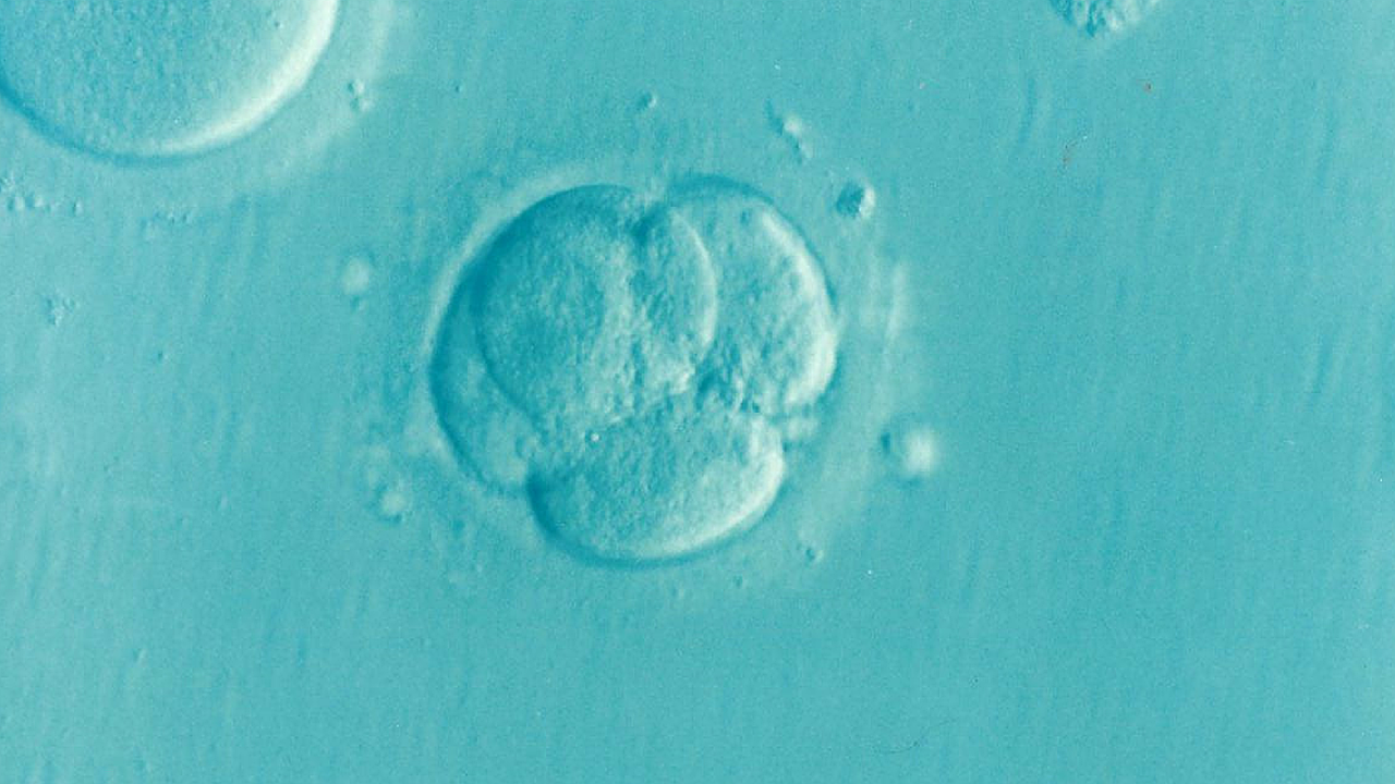 Cosa faccio embryo, ivf, microfertilization, infertility, fertility, embryo, embryo, embryo, embryo, embryo, ivf, ivf, ivf, ivf, infertility